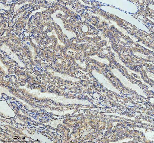 m02040 ccnb2 primary antibodies ihc testing 8