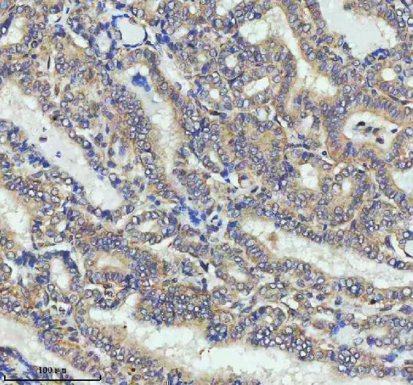 m02040 ccnb2 primary antibodies ihc testing 9
