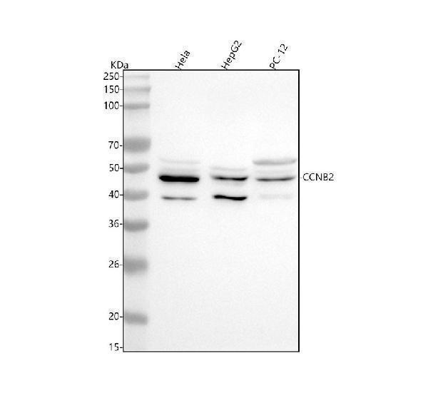  Western blot analysis of CCNB2 using anti-CCNB2 antibody (M02040)