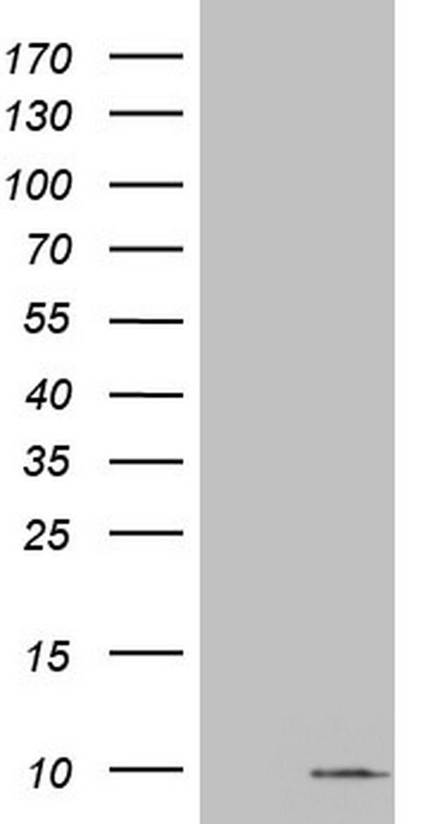 HEK293T cells were transfected with the pCMV6-ENTRY control (Left lane) or pCMV6-ENTRY S100A6 (Right lane) cDNA for 48 hrs and lysed