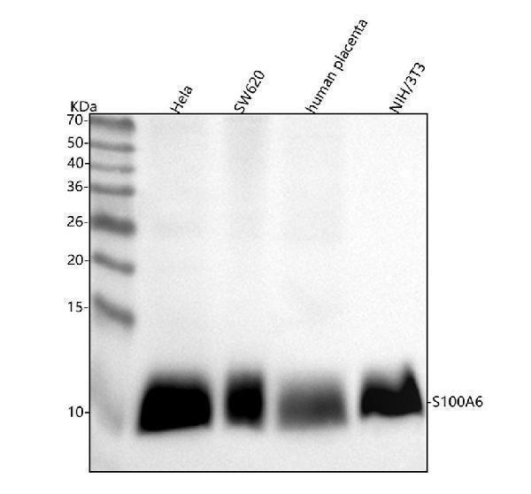  Western blot analysis of S100A6 using anti-S100A6 antibody (M02043)