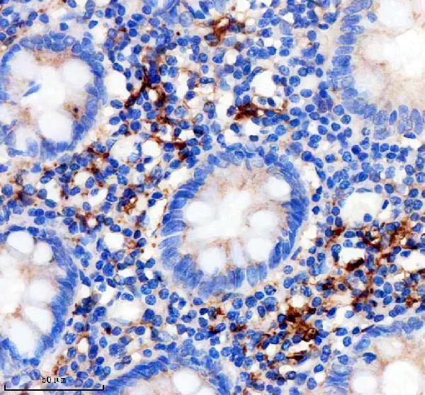 m02047 1 f13a1 primary antibodies ihc testing 1