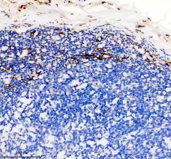 m02047 1 f13a1 primary antibodies ihc testing 2