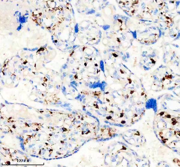 m02047 1 f13a1 primary antibodies ihc testing 3