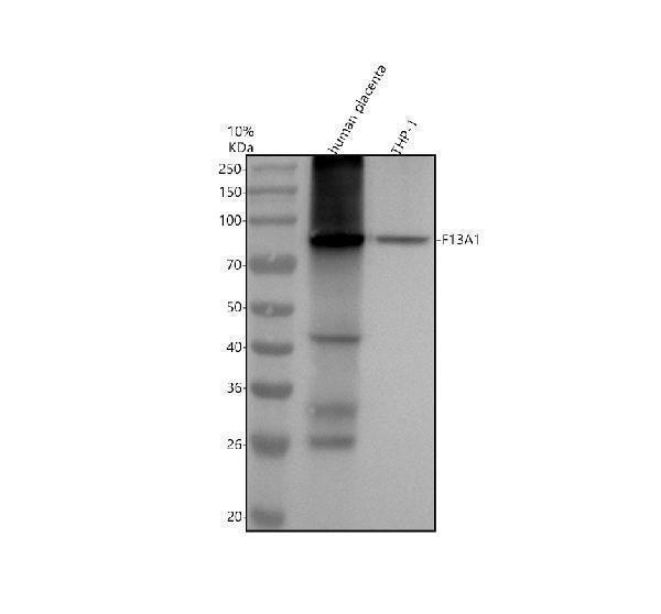 m02047 1 f13a1 primary antibodies wb testing 1