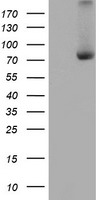 HEK293T cells were transfected with the pCMV6-ENTRY control (Left lane) or pCMV6-ENTRY C1S (Right lane) cDNA for 48 hrs and lysed