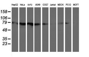Western blot analysis of extracts (35ug) from 9 different cell lines by using anti-C1S monoclonal antibody (HepG2: human; HeLa: human; SVT2: mouse; A549: human; COS7: monkey; Jurkat: human; MDCK: canine; PC12: rat; MCF7: human)
