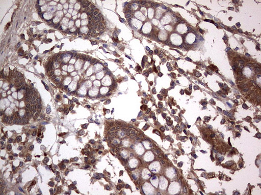 Immunohistochemical staining of paraffin-embedded Human colon tissue within the normal limits using anti-ARAF mouse monoclonal antibody