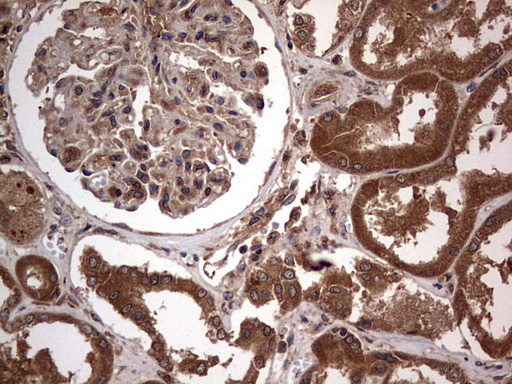 Immunohistochemical staining of paraffin-embedded Human Kidney tissue within the normal limits using anti-ARAF mouse monoclonal antibody