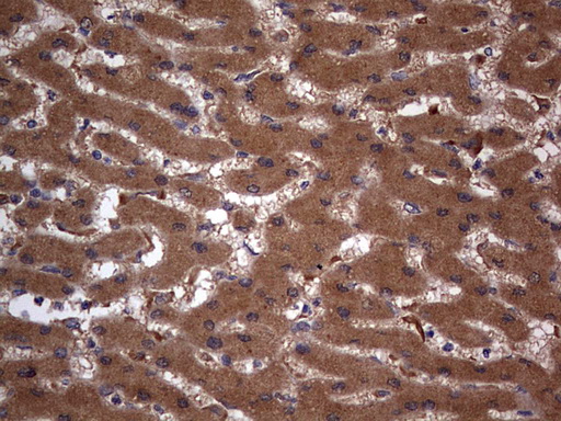 m02061 1 anti a raf araf mouse monoclonal antibody clone id oti2g9 ihc testing 13