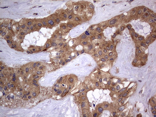 m02061 1 anti a raf araf mouse monoclonal antibody clone id oti2g9 ihc testing 14