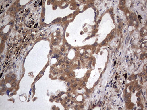 m02061 1 anti a raf araf mouse monoclonal antibody clone id oti2g9 ihc testing 2
