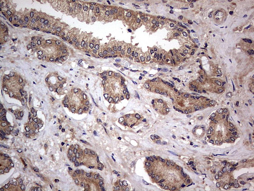 m02061 1 anti a raf araf mouse monoclonal antibody clone id oti2g9 ihc testing 4