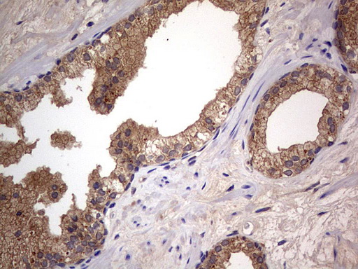m02061 1 anti a raf araf mouse monoclonal antibody clone id oti2g9 ihc testing 5