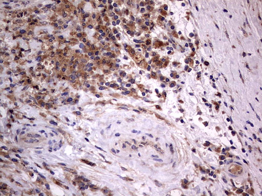 m02061 1 anti a raf araf mouse monoclonal antibody clone id oti2g9 ihc testing 6