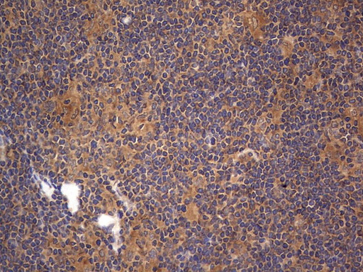 m02061 1 anti a raf araf mouse monoclonal antibody clone id oti2g9 ihc testing 7