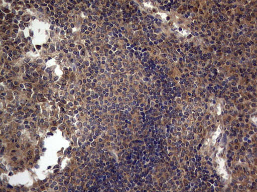 m02061 1 anti a raf araf mouse monoclonal antibody clone id oti2g9 ihc testing 8