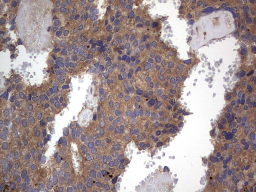 m02061 1 anti a raf araf mouse monoclonal antibody clone id oti2g9 ihc testing 9