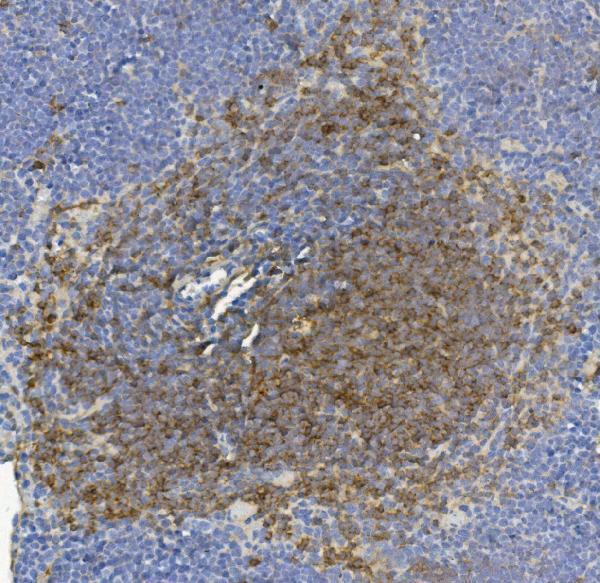  IHC analysis of IL-17F using anti-IL-17F antibody (M02062)