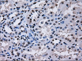 m02067 1 anti rpa34 rpa2 mouse monoclonal antibody clone id oti1h10 ihc testing 11