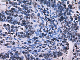 m02067 1 anti rpa34 rpa2 mouse monoclonal antibody clone id oti1h10 ihc testing 4
