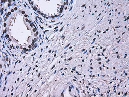 m02067 1 anti rpa34 rpa2 mouse monoclonal antibody clone id oti1h10 ihc testing 7