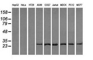 m02067 1 anti rpa34 rpa2 mouse monoclonal antibody clone id oti1h10 wb testing 2