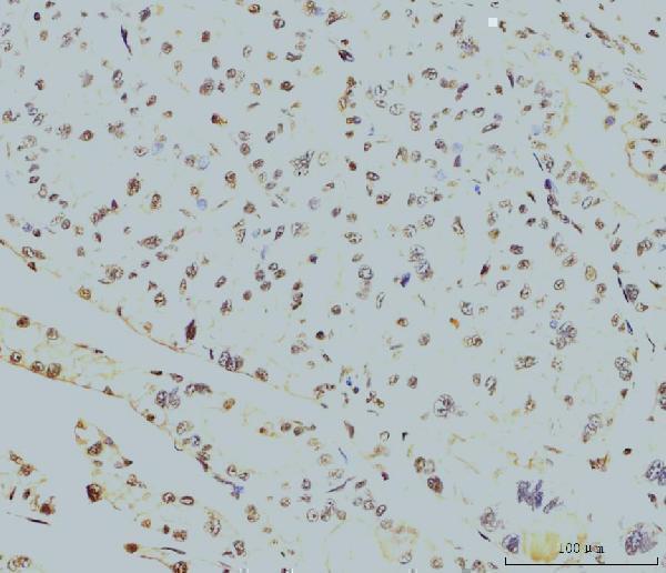 m02067 2 rpa2 primary antibodies ihc testing 4