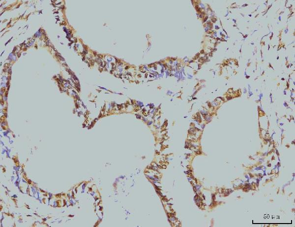 m02067 2 rpa2 primary antibodies ihc testing 5