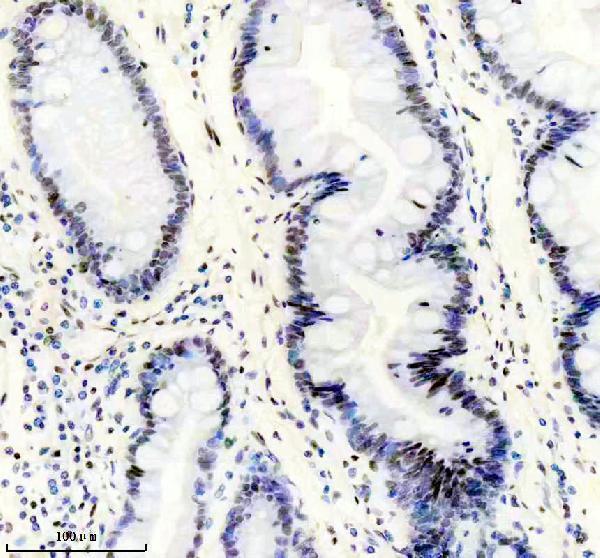 m02067 3 rpa2 primary antibodies ihc testing 1