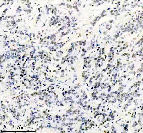 m02067 3 rpa2 primary antibodies ihc testing 2