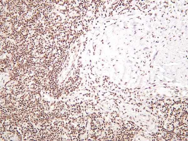 m02067 5 rpa2 primary antibodies ihc testing 2