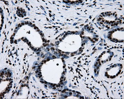 m02067 anti rpa34 rpa2 mouse monoclonal antibody clone id oti9a1 ihc testing 10