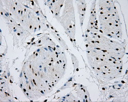 m02067 anti rpa34 rpa2 mouse monoclonal antibody clone id oti9a1 ihc testing 11
