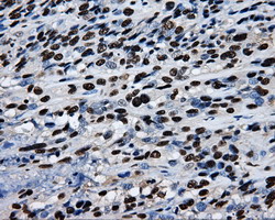 m02067 anti rpa34 rpa2 mouse monoclonal antibody clone id oti9a1 ihc testing 12
