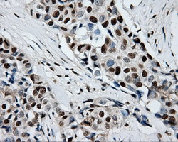 m02067 anti rpa34 rpa2 mouse monoclonal antibody clone id oti9a1 ihc testing 13