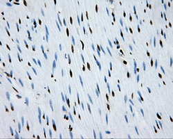 m02067 anti rpa34 rpa2 mouse monoclonal antibody clone id oti9a1 ihc testing 14
