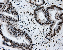 m02067 anti rpa34 rpa2 mouse monoclonal antibody clone id oti9a1 ihc testing 15