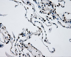 m02067 anti rpa34 rpa2 mouse monoclonal antibody clone id oti9a1 ihc testing 17