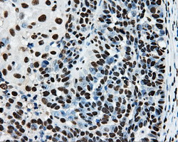 m02067 anti rpa34 rpa2 mouse monoclonal antibody clone id oti9a1 ihc testing 3
