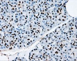 m02067 anti rpa34 rpa2 mouse monoclonal antibody clone id oti9a1 ihc testing 4