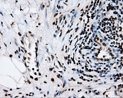 m02067 anti rpa34 rpa2 mouse monoclonal antibody clone id oti9a1 ihc testing 5