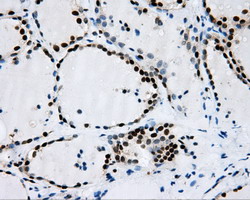 m02067 anti rpa34 rpa2 mouse monoclonal antibody clone id oti9a1 ihc testing 6