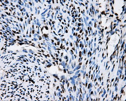 m02067 anti rpa34 rpa2 mouse monoclonal antibody clone id oti9a1 ihc testing 7