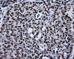 m02067 anti rpa34 rpa2 mouse monoclonal antibody clone id oti9a1 ihc testing 8