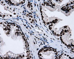 m02067 anti rpa34 rpa2 mouse monoclonal antibody clone id oti9a1 ihc testing 9