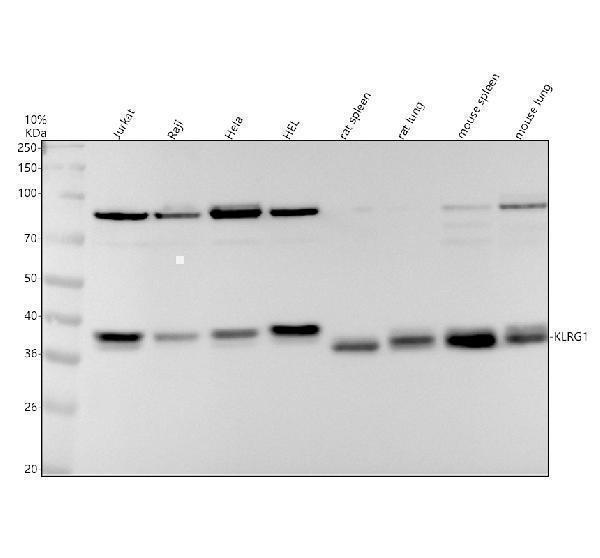 Western blot analysis of KLRG1 using anti-KLRG1 antibody (M02084)