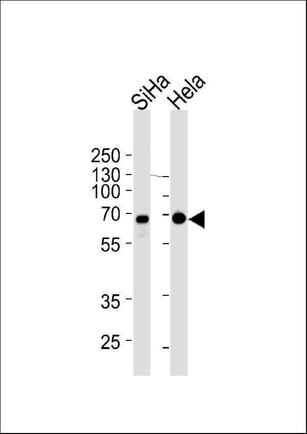 NLK Antibody western blot analysis in SiHa,Hela cell line lysates (35μg/lane)