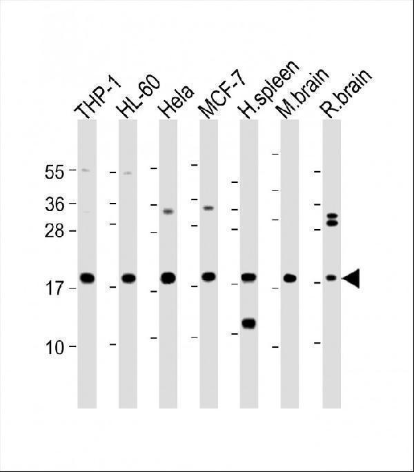 All lanes : Anti-ARPC5 Antibody (Center) at 1:2000 dilutionLane 1: THP-1 whole cell lysateLane 2: HL-60 whole cell lysateLane 3: Hela whole cell lysateLane 4: MCF-7 whole cell lysateLane 5: Human spleen lysateLane 6: Mouse brain lysateLane 7: Rat brain lysateLysates/proteins at 20 µg per lane