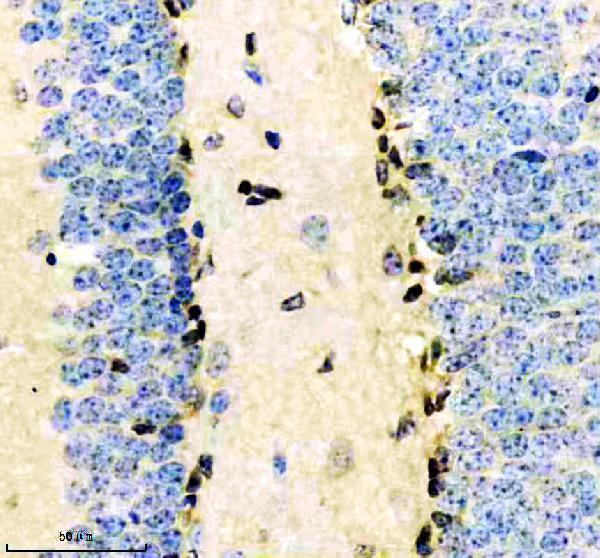 IHC analysis of CRKL using anti-CRKL antibody (M02100-2)